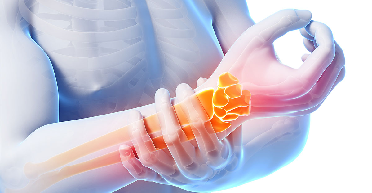 Ronkonkoma natural carpal tunnel treatment